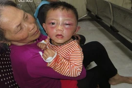 Bắt khẩn cấp gã cha dượng đánh gục con riêng của vợ