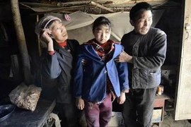 Kỳ lạ cô bé ăn 8 bữa/ngày, 3 cân gạo vẫn gầy