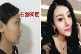 30 ngày biến hoá của cô nàng phẫu thuật thẩm mỹ