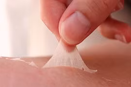 Hình ảnh chứng tỏ bạn bị ung thư da (3)