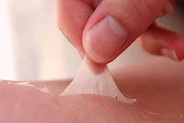 Hình ảnh chứng tỏ bạn bị ung thư da (3)