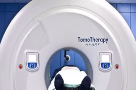 Tác dụng của xạ trị mới với ung thư đầu và cổ