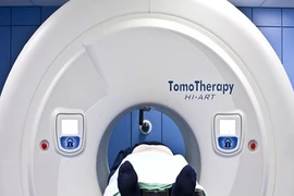 Tác dụng của xạ trị mới với ung thư đầu và cổ