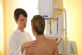 Lười tập thể dục làm tăng nguy cơ ung thư