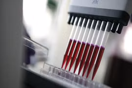 Vai trò của bộ máy kháng thể trong bệnh bạch cầu