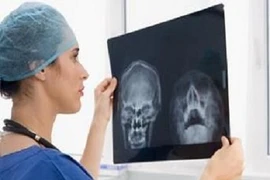 Chi tiết quá trình phẫu thuật hàm dưới trị ung thư