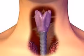 8 nguyên nhân gây ra ung thư thanh quản