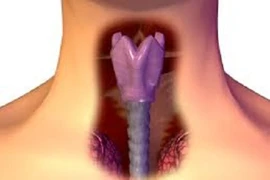 8 nguyên nhân gây ra ung thư thanh quản