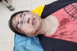 Chuẩn bị ra toà ly hôn, người phụ nữ bị chồng đánh nhập viện