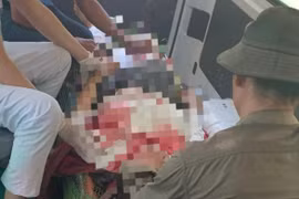 Người phụ nữ bị đá rơi trúng người khi đi dọn thực bì