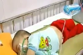 Bộ Y tế được, mất gì khi công bố dịch sởi?