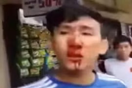 GĐ Công an chỉ đạo làm rõ vụ dân “tố” CSCĐ đánh người