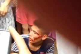 Dân vây đánh, hô đốt tên trộm xe máy