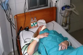 Nữ du khách Nga bị thương khi tắm biển do cá nhái cắn