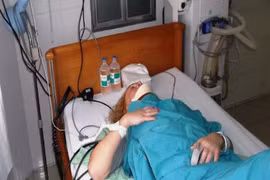 Nữ du khách Nga bị thương khi tắm biển do cá nhái cắn