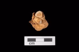 Thứ đáng sợ trong bụng cô gái Ai Cập 3000 năm tuổi