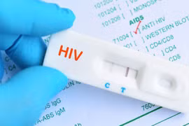 Một số biện pháp được khuyến cáo giúp phòng ngừa lây nhiễm HIV