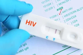 Một số biện pháp được khuyến cáo giúp phòng ngừa lây nhiễm HIV