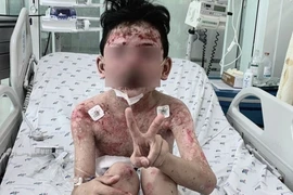 Bé trai mắc bệnh lạ nguy hiểm sau 2 ngày ăn cua