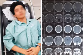 Vụ nam sinh bị hành hung nứt sọ não: Nghi do mâu thuẫn tình cảm