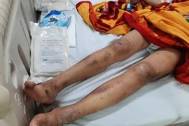 Cô gái trẻ bị gã chủ quán tra tấn dã man ở Biên Hòa - Đồng Nai vì không kích dục cho khách