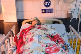 Gia Lai: Nam sinh bị đâm thủng phổi khi chơi bida