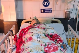 Gia Lai: Nam sinh bị đâm thủng phổi khi chơi bida