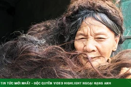 Người phụ nữ có mái tóc kì dị: Kết thành nhiều mảng, cứ cắt là đổ bệnh