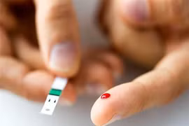 Lợi ích tuyệt vời của râu ngô đối với sức khoẻ bạn nên biết