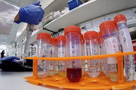 ĐSQ Việt Nam tại Trung Quốc: Chưa ghi nhận có lưu học sinh nhiễm virus corona