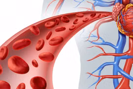 Đối tượng dễ mắc chứng bệnh cục máu đông 