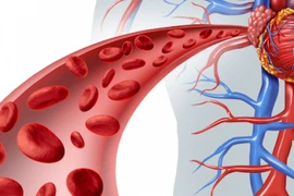 Đối tượng dễ mắc chứng bệnh cục máu đông 