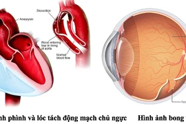 Khám sức khoẻ đi xuất khẩu, bất ngờ phát hiện bệnh hiếm nguy hiểm 