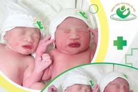 Hy hữu sinh đôi hiếm gặp: Một bé chào đời trong "bọc điều"