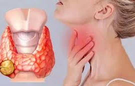 Rối loạn tuyến giáp có ảnh hưởng đến nguy cơ ung thư phụ khoa?