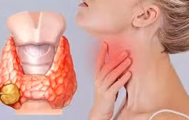 Rối loạn tuyến giáp có ảnh hưởng đến nguy cơ ung thư phụ khoa?