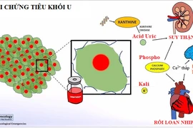 Hội chứng tiêu khối u đe dọa tính mạng người bệnh