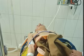 Suy đa tạng, tổn thương não vì sốc nhiệt: Xử trí ban đầu thế nào?