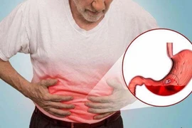 Bác sĩ chỉ rõ thói quen khiến chữa dạ dày mãi không khỏi