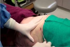 Hút mỡ bụng bị tử vong: HCM chỉ đạo các hoạt động an toàn thẩm mỹ