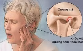 Địa chỉ vàng: Nơi khám chữa viêm khớp thái dương hàm tốt