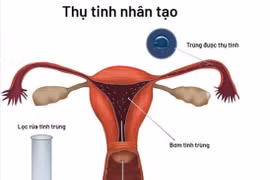 Cách chăm sóc thai thụ tinh ống nghiệm 3 tháng đầu