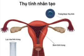Cách chăm sóc thai thụ tinh ống nghiệm 3 tháng đầu