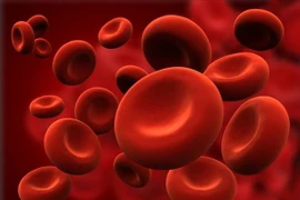 Thiếu sắt gây thiếu máu