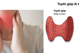 U tuyến cận giáp và những điều cần biết