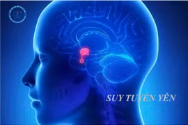 Sau sinh cẩn thận mắc bệnh suy tuyến yên nguy hiểm: cần nhận biết sớm