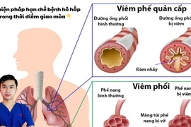 6 biện pháp hạn chế bệnh hô hấp trong thời điểm giao mùa
