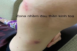 Nhiều người bị những bệnh lý hay gặp dễ nhầm lẫn với đau xương khớp