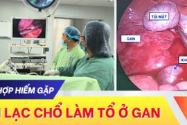 Hy hữu: Thai lạc chỗ làm tổ ở gan