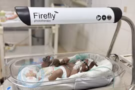 Chủ quan vàng da trẻ sơ sinh bị biến chứng thần kinh, đe dọa tử vong